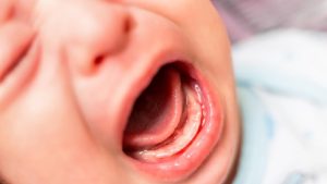 Balita Luka Parah di Daycare, Orang Tua Lapor Polisi!